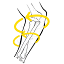 Torsion